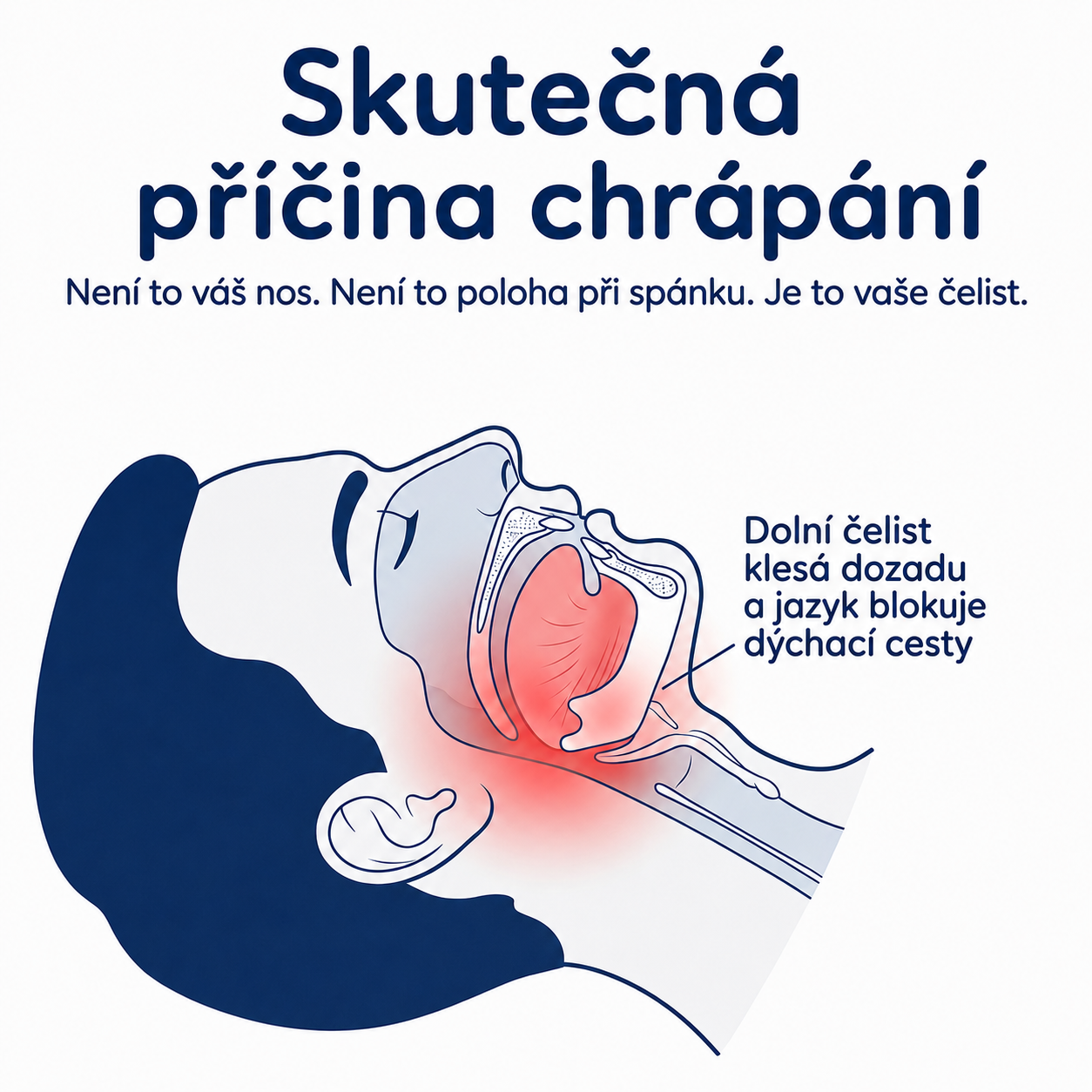1+1 ZDARMA DNES! Zbavte se chrápání už od první noci – SomnoLab (+ hygienické ochranné pouzdro ZDARMA)